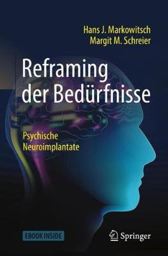 Cover image for Reframing der Bedurfnisse: Psychische Neuroimplantate