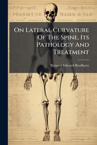 Cover image for On Lateral Curvature of the Spine, Its Pathology and Treatment