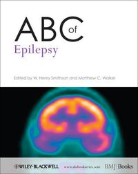 Cover image for ABC of Epilepsy