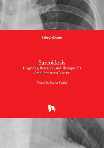 Cover image for Sarcoidosis