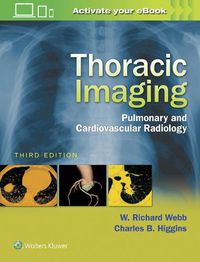 Cover image for Thoracic Imaging: Pulmonary and Cardiovascular Radiology