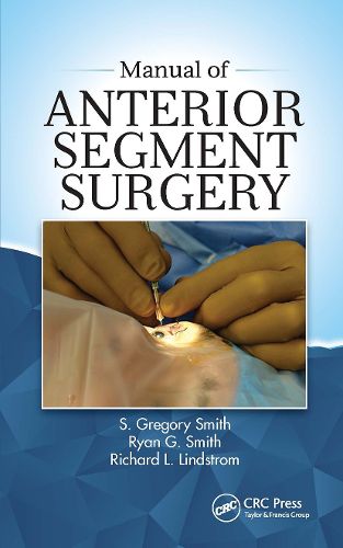 Manual of Anterior Segment Surgery