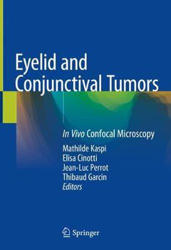 Cover image for Eyelid and Conjunctival Tumors: In Vivo Confocal Microscopy