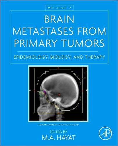 Cover image for Brain Metastases from Primary Tumors, Volume 2: Epidemiology, Biology, and Therapy