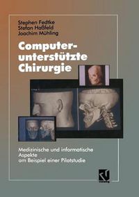 Cover image for Computerunterstutzte Chirurgie: Medizinische Und Informatische Aspekte Am Beispiel Einer Pilotstudie