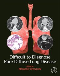 Cover image for Difficult to Diagnose Rare Diffuse Lung Disease