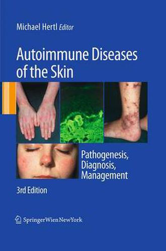 Cover image for Autoimmune Diseases of the Skin: Pathogenesis, Diagnosis, Management