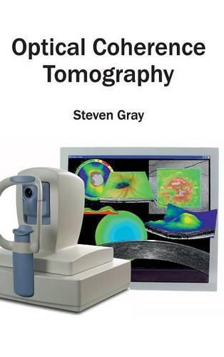 Cover image for Optical Coherence Tomography