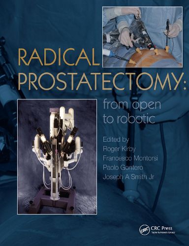 Cover image for Radical Prostatectomy: From Open to Robotic