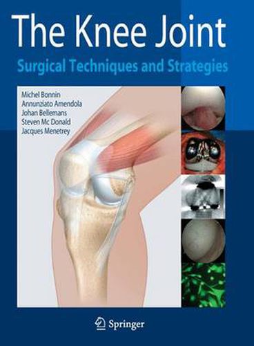 The Knee Joint: Surgical Techniques and Strategies