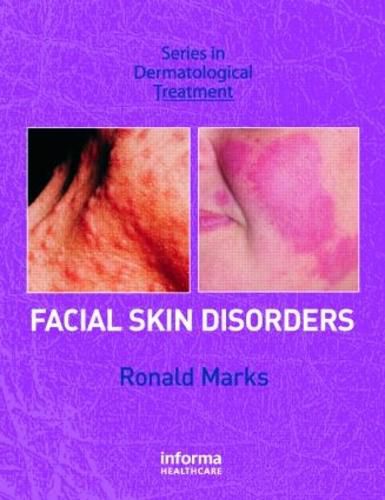 Cover image for Facial Skin Disorders