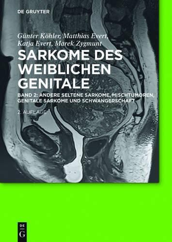 Cover image for Andere Seltene Sarkome, Mischtumoren, Genitale Sarkome Und Schwangerschaft