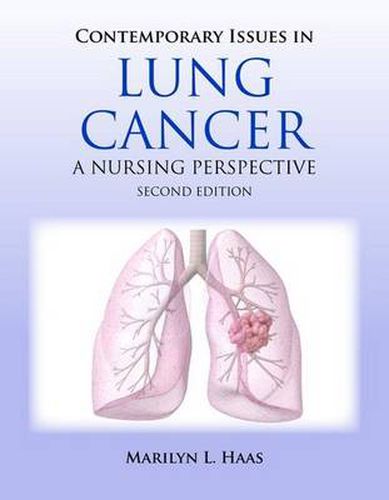 Cover image for Contemporary Issues In Lung Cancer