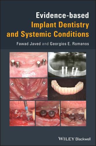 Cover image for Evidence-based Implant Dentistry and Systemic Conditions