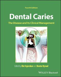 Cover image for Dental Caries