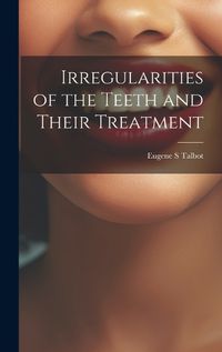 Cover image for Irregularities of the Teeth and Their Treatment