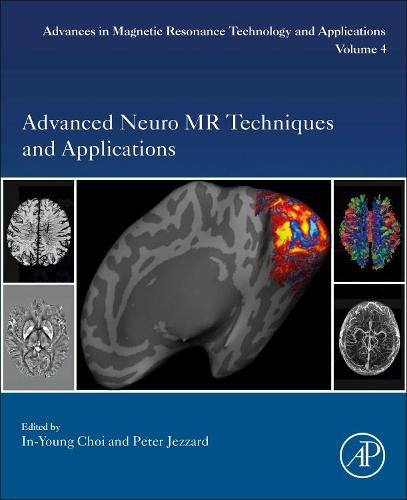 Cover image for Advanced Neuro MR Techniques and Applications