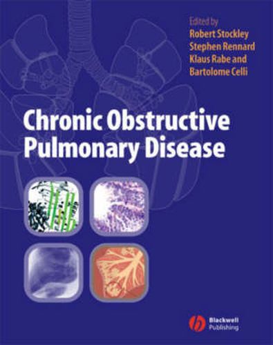 Cover image for Chronic Obstructive Pulmonary Disease: A Practical Guide to Management