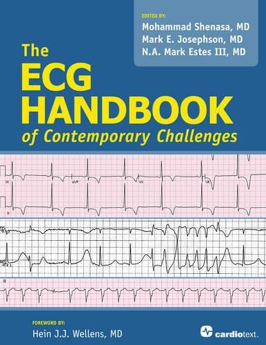 Cover image for ECG Handbook of Contemporary Challenges