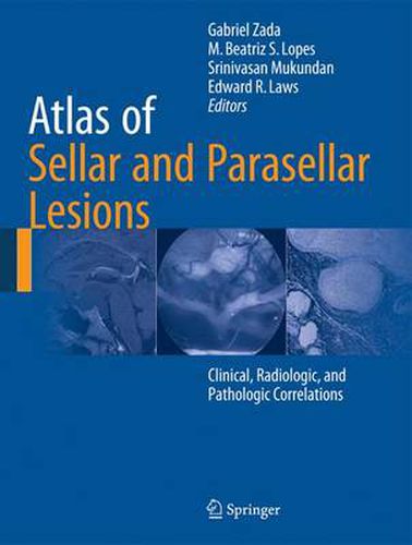 Cover image for Atlas of Sellar and Parasellar Lesions: Clinical, Radiologic, and Pathologic Correlations