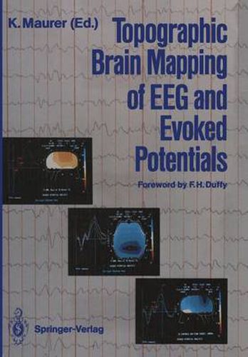 Cover image for Topographic Brain Mapping of EEG and Evoked Potentials