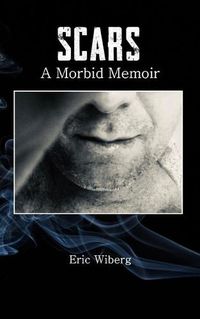 Cover image for Scars: A Morbid Memoir