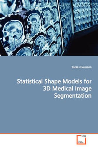 Cover image for Statistical Shape Models for 3D Medical Image Segmentation