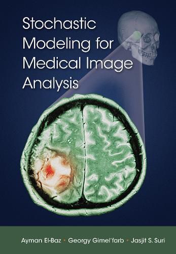 Cover image for Stochastic Modeling for Medical Image Analysis