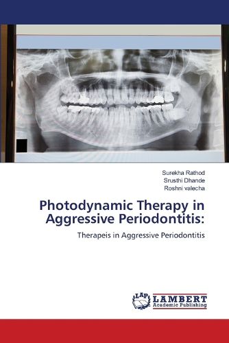 Cover image for Photodynamic Therapy in Aggressive Periodontitis
