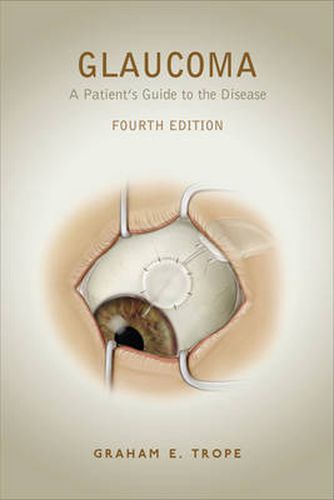 Cover image for Glaucoma: A Patient's Guide to the Disease