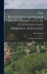 Cover image for Die Beleuchtungsbilder des Trommelfells im Gesunden und Kranken Zustande