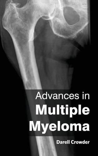 Cover image for Advances in Multiple Myeloma