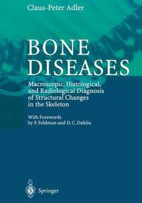 Cover image for Bone Diseases