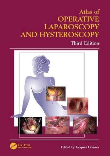 Cover image for Atlas of Operative Laparoscopy and Hysteroscopy