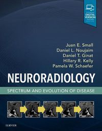 Cover image for Neuroradiology: Spectrum and Evolution of Disease