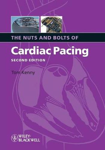 Cover image for The Nuts and Bolts of Cardiac Pacing