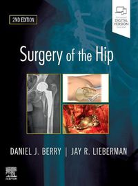 Cover image for Surgery of the Hip