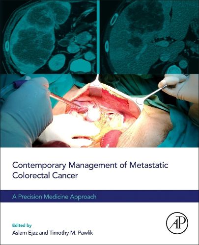Cover image for Contemporary Management of Metastatic Colorectal Cancer: A Precision Medicine Approach
