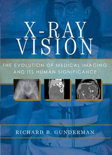 Cover image for X-Ray Vision: The Evolution of Medical Imaging and Its Human Significance