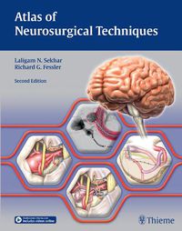 Cover image for Atlas of Neurosurgical Techniques: Brain