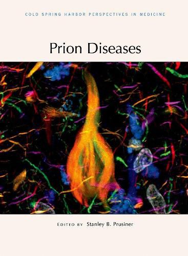 Cover image for Prion Diseases