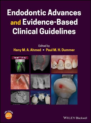 Cover image for Endodontic Advances and Evidence-Based Clinical Gu idelines