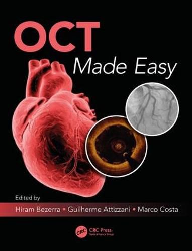 Cover image for OCT Made Easy