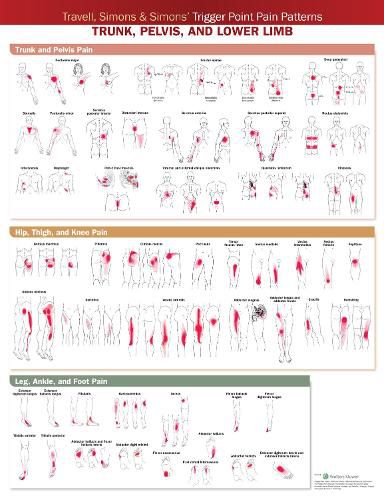 Cover image for Travell, Simons & Simons' Trigger Point Pain Patterns Wall Chart