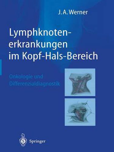 Cover image for Lymphknotenerkrankungen Im Kopf-Hals-Bereich: Onkologie Und Differenzialdiagnostik