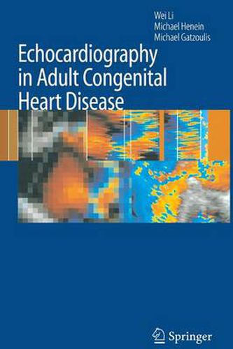 Echocardiography in Adult Congenital Heart Disease