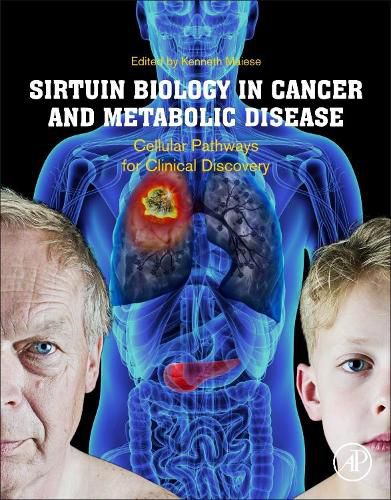 Cover image for Sirtuin Biology in Cancer and Metabolic Disease: Cellular Pathways for Clinical Discovery