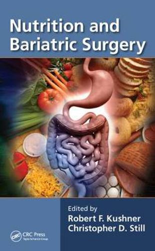 Cover image for Nutrition and Bariatric Surgery