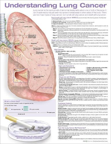 Cover image for Understanding Lung Cancer Anatomical Chart