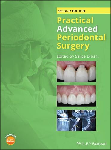 Cover image for Practical Advanced Periodontal Surgery, 2nd 2nd Edition